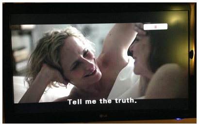 Concussion